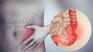 Alles wat u moet weten over darmziekten: Symptomen, Diagnose en Behandeling