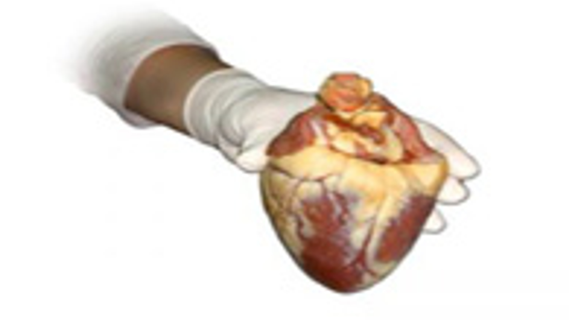 De Hoopvolle Wereld van Orgaantransplantaties