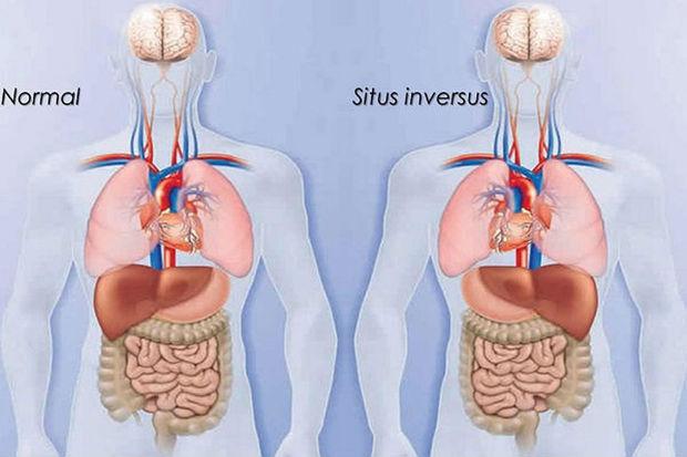 Levensreddende Band tussen Organen en Ontvangers