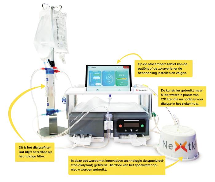 Optimaliseren van Post Transplantatiezorg voor Een Succesvol Herstel
