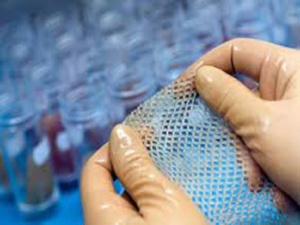 Huidtransplantatie: Een Innovatieve Behandeling voor Huidaandoeningen