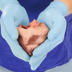 Optimale nazorg na orgaantransplantatie: essentieel voor herstel en welzijn