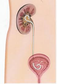 De Rol van een Katheter in de Medische Praktijk