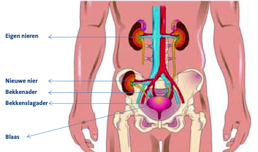 Belangrijke Richtlijnen voor Herstel Na de Niertransplantatie