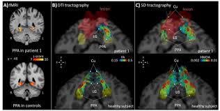 Innovatieve Medische Oplossingen van PPA Medisch